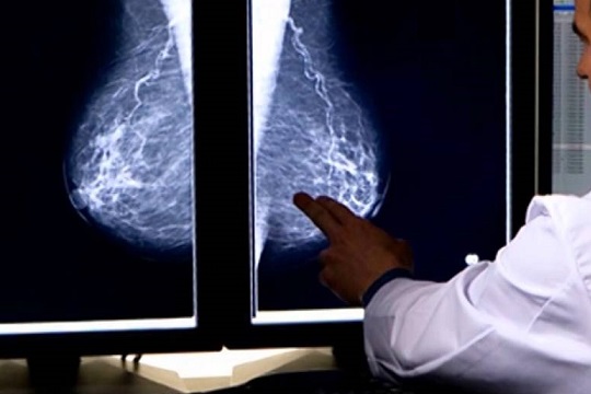 Whan is mammography with tomosynthesis