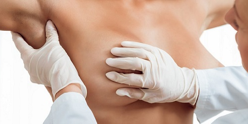 What is a breast care specialist?