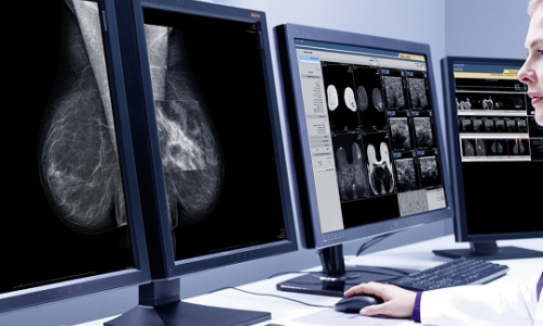 Digital mammography