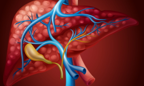 Liver cirrhosis: main symptoms and treatment