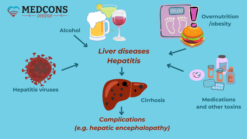 Liver cirrhosis: causes and stages