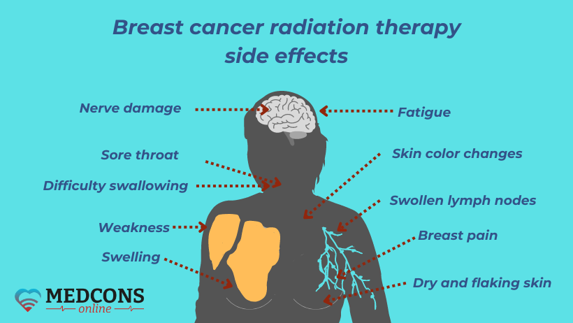 Breast cancer radiotherapy side effects