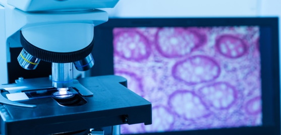 Digital Pathology Is Another Way to Get Remote Advice