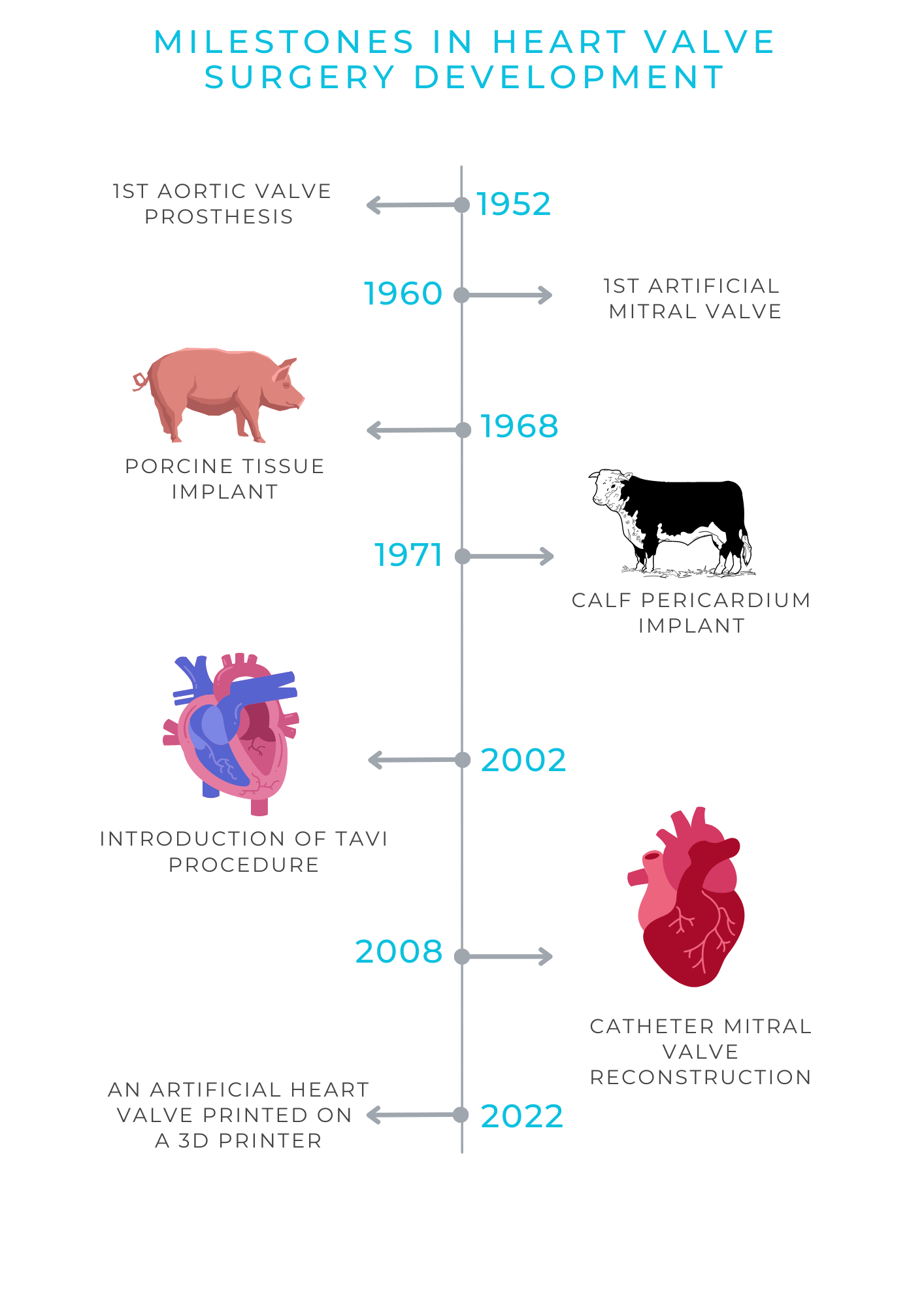Stages of modern heart valve surgery development in medicine
