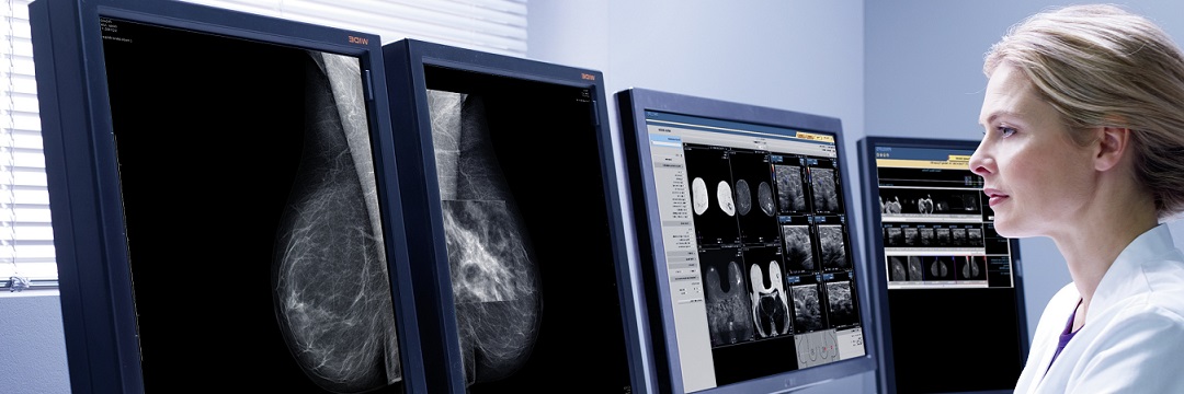 Маммография ростов на дону. УЗИ молочных желез у подростков. Мрт снимки. Узловая мастопатия на маммографии. Кт и мрт.