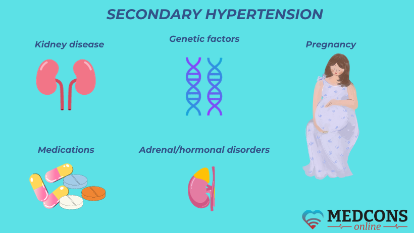 Secondary hypertension causes