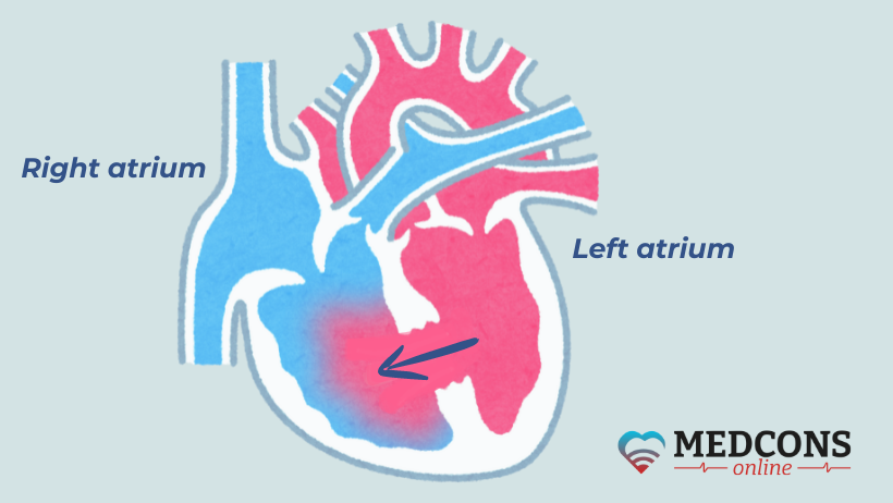 Blood flows from the left to the right atrium due to a septal defect