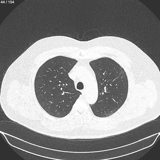 healthy lungs